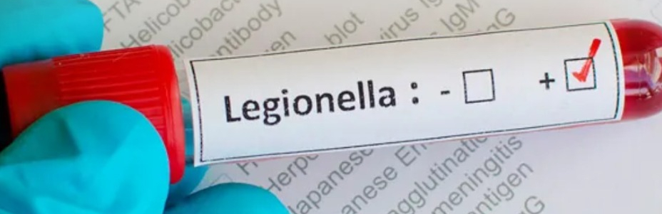 Why Do I Need A Legionella Risk Assessment Why Do I Need A Legionella Risk Assessment